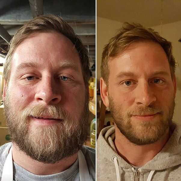 appearance before and after alcohol consumption